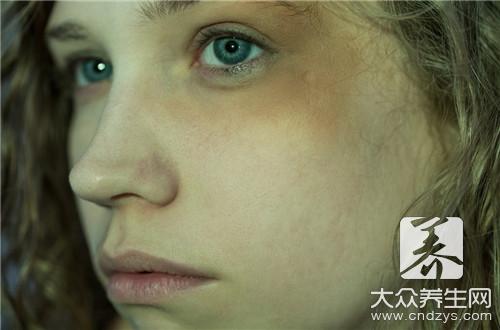 黑眼圈和眼袋鉴别图