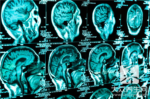 大脑灰质的作用